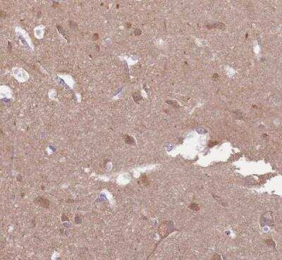 Immunohistochemistry-Paraffin: EMC1 Antibody [NBP2-14151]