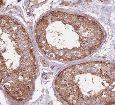 Immunohistochemistry-Paraffin: EMC1 Antibody [NBP2-14151]