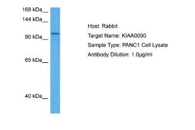 Western Blot: EMC1 Antibody [NBP2-87357]