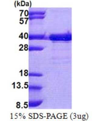 SDS-PAGE: Recombinant Human EMC2 His Protein [NBP2-23028]