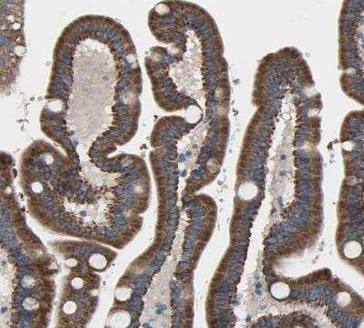 Immunohistochemistry-Paraffin: EMC7 Antibody [NBP1-88547]