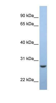 Western Blot: EMC7 Antibody [NBP1-62595]