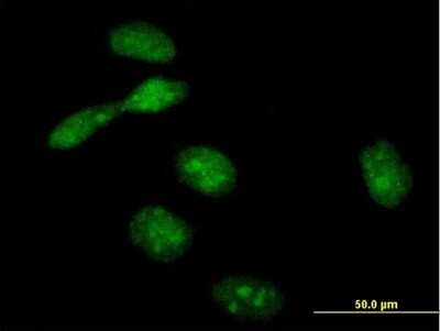 Immunocytochemistry/ Immunofluorescence: EME1 Antibody [H00146956-B01P]
