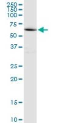 Western Blot: EME1 Antibody [H00146956-B01P]