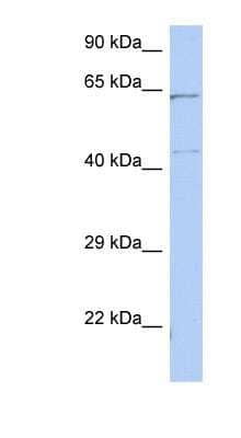 Western Blot: EME1 Antibody [NBP1-55350]