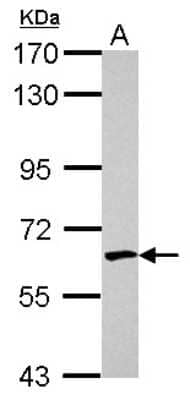 Western Blot: EME1 Antibody [NBP2-16325]