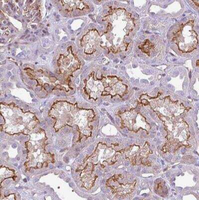 Immunohistochemistry-Paraffin: EME2 Antibody [NBP2-30885]