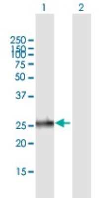 Western Blot: EMG1 Antibody [H00010436-B01P]