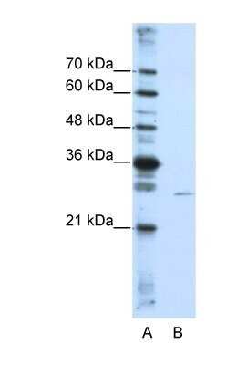 Western Blot: EMG1 Antibody [NBP1-57410]