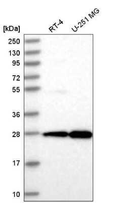 Western Blot: EMG1 Antibody [NBP2-55324]