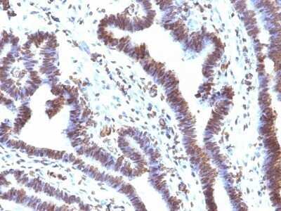 Immunohistochemistry-Paraffin: EMI1 Antibody (EMI1/1176) - Azide and BSA Free [NBP2-47786]