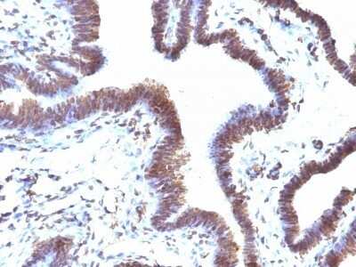 Immunohistochemistry-Paraffin: EMI1 Antibody (EMI1/1176) - Azide and BSA Free [NBP2-47786]