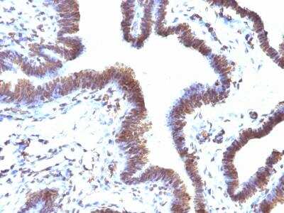 Immunohistochemistry-Paraffin: EMI1 Antibody (EMI1/1176) - IHC-Prediluted [NBP2-48221]