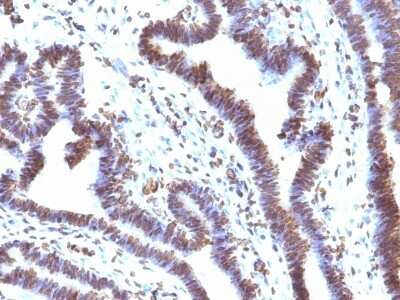Immunohistochemistry-Paraffin: EMI1 Antibody (EMI1/1176) [NBP2-44344]