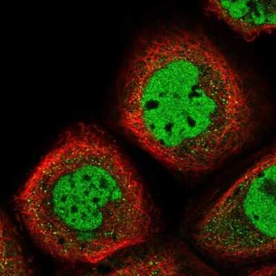 Immunocytochemistry/ Immunofluorescence: EMI1 Antibody [NBP1-84850]