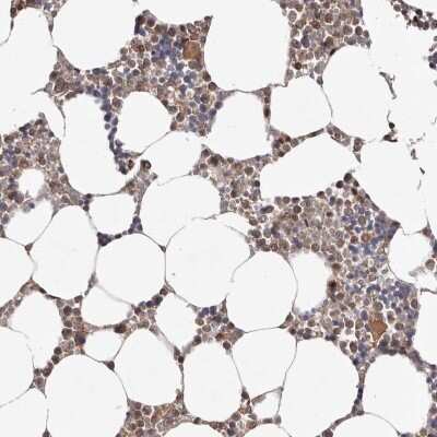 Immunohistochemistry-Paraffin: EMI1 Antibody [NBP1-84850]