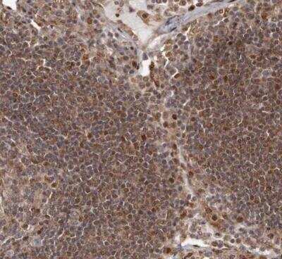 Immunohistochemistry-Paraffin: EMI1 Antibody [NBP1-84850]