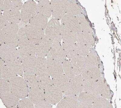 Immunohistochemistry-Paraffin: EMI1 Antibody [NBP1-84850]