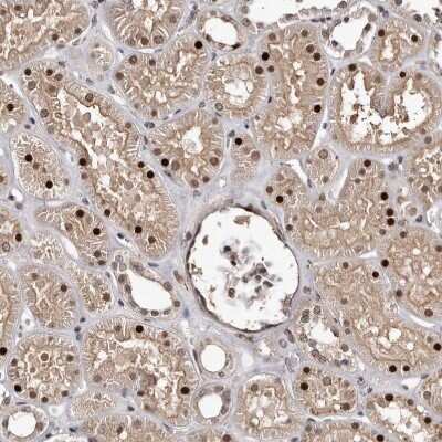Immunohistochemistry-Paraffin: EMI1 Antibody [NBP1-84850]