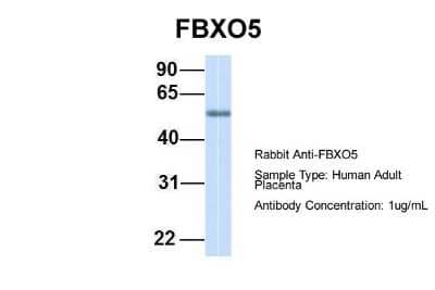 Western Blot: EMI1 Antibody [NBP1-55050]