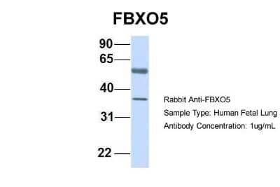 Western Blot: EMI1 Antibody [NBP1-55050]