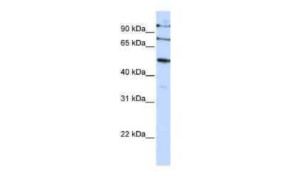 Western Blot: EMI1 Antibody [NBP1-55050]