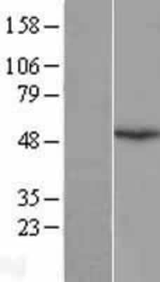 Western Blot: EMI1 Overexpression Lysate [NBL1-10639]