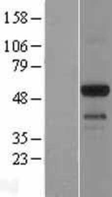 Western Blot: EMID1 Overexpression Lysate [NBL1-10255]