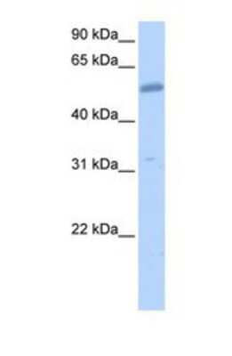 Western Blot: EMID2 Antibody [NBP1-69681]