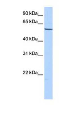 Western Blot: EMID2 Antibody [NBP1-69698]