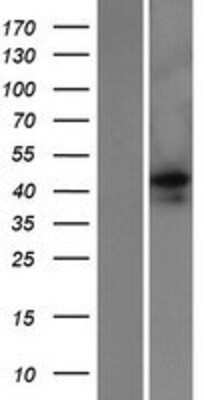 Western Blot: EMID2 Overexpression Lysate [NBP2-05699]