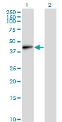 Western Blot: EMILIN1 Antibody (4A3) [H00011117-M01]