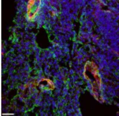 Immunocytochemistry/ Immunofluorescence: EMILIN1 Antibody (C11A8) - Azide and BSA Free [NBP2-36338]