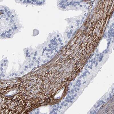Immunohistochemistry-Paraffin: EMILIN1 Antibody [NBP1-84127]