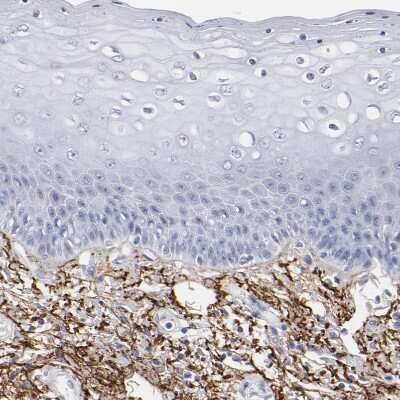 Immunohistochemistry-Paraffin: EMILIN1 Antibody [NBP1-84127]