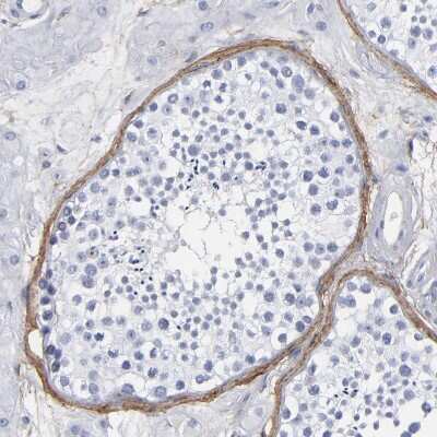 Immunohistochemistry-Paraffin: EMILIN1 Antibody [NBP1-84127]