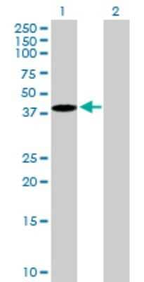 Western Blot: EMILIN1 Antibody [H00011117-B01P]