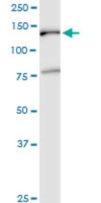 Western Blot: EMILIN2 Antibody (3D9) [H00084034-M01]