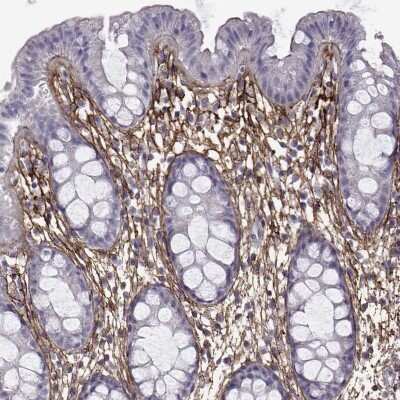 Immunohistochemistry-Paraffin: EMILIN2 Antibody [NBP2-68819]