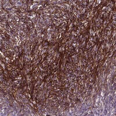 Immunohistochemistry: EMILIN3 Antibody [NBP2-49308]