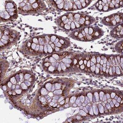 Immunohistochemistry-Paraffin: EMILIN3 Antibody [NBP2-14534]