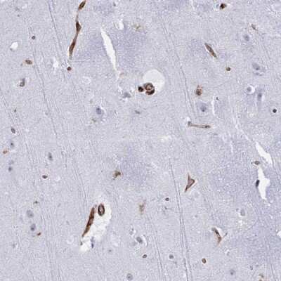 Immunohistochemistry: EML1 Antibody [NBP2-38601]