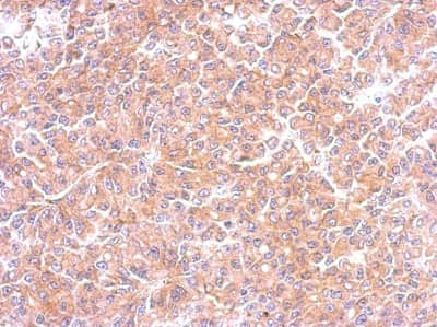 Immunohistochemistry-Paraffin: EML1 Antibody [NBP1-30956]