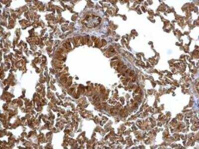 Immunohistochemistry-Paraffin: EML1 Antibody [NBP1-30956]