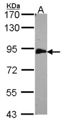 Western Blot: EML1 Antibody [NBP1-30956]