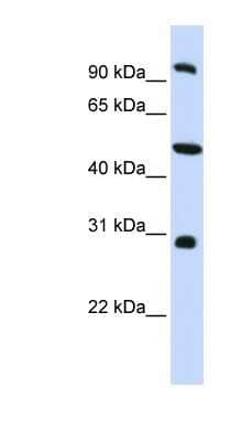 Western Blot: EML1 Antibody [NBP1-56595]