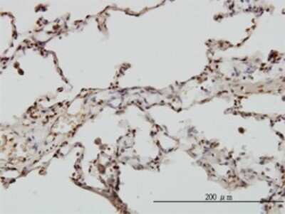 Immunohistochemistry-Paraffin: EML2 Antibody (2H6) [H00024139-M01]