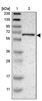 Western Blot: EML2 Antibody [NBP1-84861]