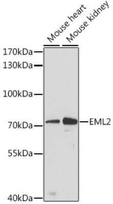 Western Blot: EML2 AntibodyAzide and BSA Free [NBP3-04734]