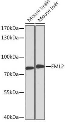 Western Blot: EML2 AntibodyAzide and BSA Free [NBP3-04735]